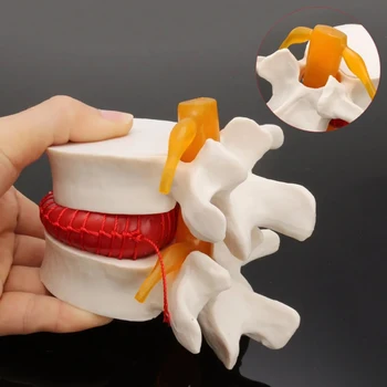 Človeška Anatomija Kosti Hrbtenice, Ledveni Disk Herniation Poučevanja Model Možganov, Lobanje Travmatičnih Pištolo Šolske Potrebščine Medicinske Instrume