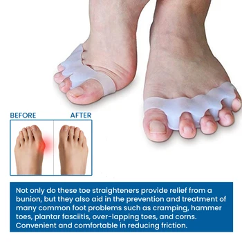 1 Par Silikonski Toe Ravnalec Noge, Kosti Palca Geli Dihanje Super Mehka Bunion Korektor Za Zmanjševanje Trenja Med Prste 0